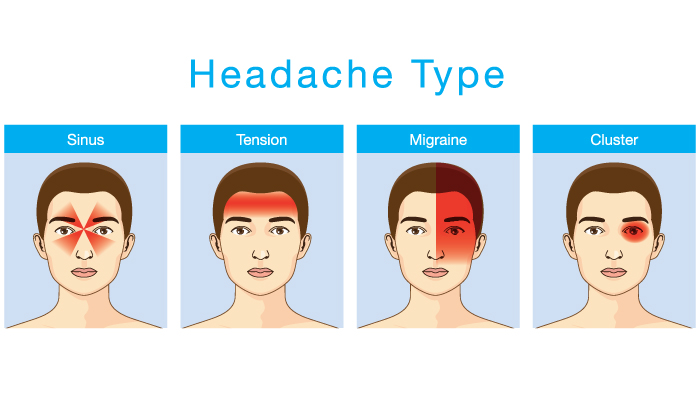 Headache Types | Han's Chiropractic & Acupuncture Palatine