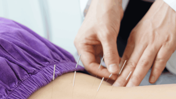 How Acupuncture Helps with Chronic Pain
