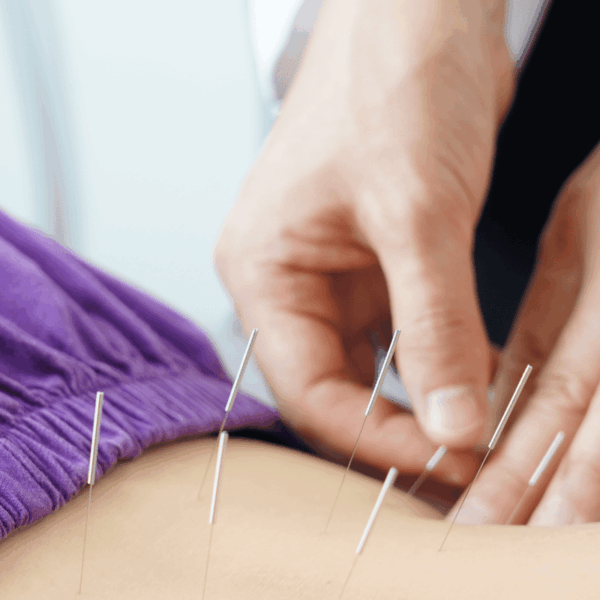 How Acupuncture Helps with Chronic Pain
